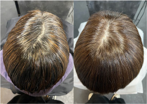 フェイディングカラー施術写真