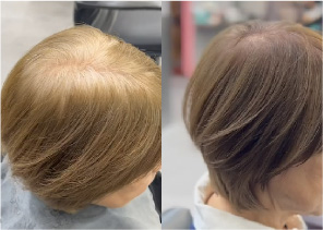 フェイディングカラー施術写真