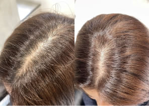 フェイディングカラー施術写真